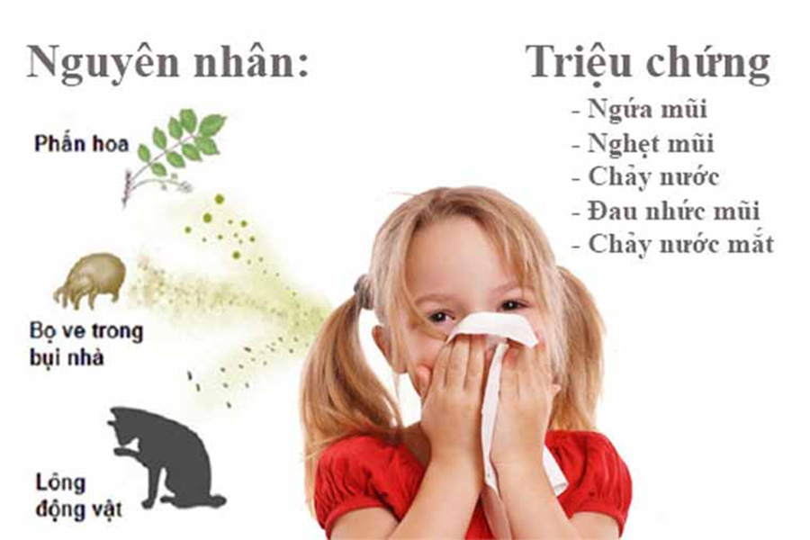 Bệnh viêm mũi dị ứng ở trẻ em xảy ra theo mùa hoặc quanh năm, do nhiều nguyên nhân