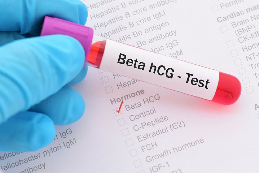 Xét nghiệm Beta HCG để biết cơ thể có đang mang thai khi kinh nguyệt không đều không
